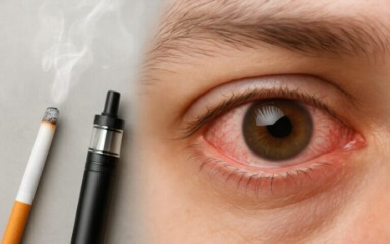 Smoking and uveitis: a hidden but preventable risk
