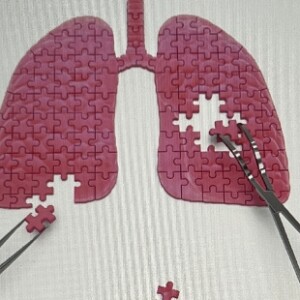 Prof. dr. Jules van den Bosch Symposium XIV:Progressive Pulmonary Fibrosis: An interplay between autoimmunity, inflammation and fibrogenesis @ Antropia, Cultuur en congrescentrum